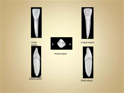 Morphology Of Mandibular Central And Lateral Incisors Teeth Ppt