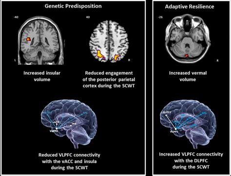 Frontiers Brain Structural And Functional Correlates Of Resilience To