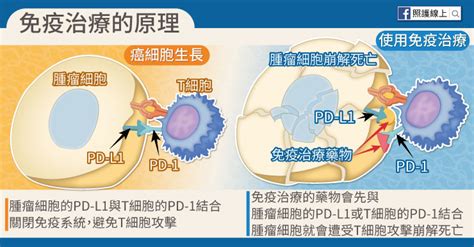 肺癌第三期怎麼辦？醫師圖文解說