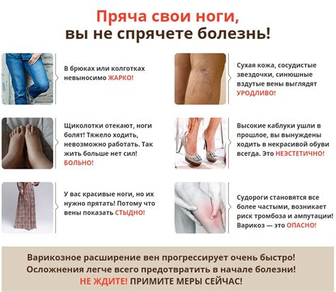 «ДАР ДРАКОНА» гель от варикоза – реальные отзывы, цена, развод или нет