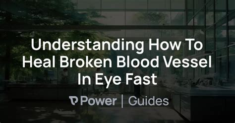 Understanding How To Heal Broken Blood Vessel In Eye Fast | Power