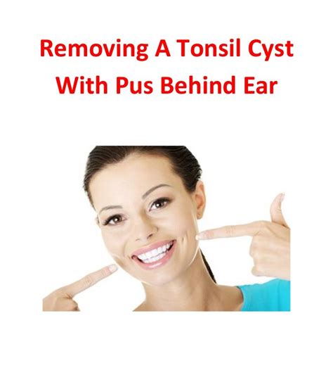 Removing a tonsil cyst with pus behind ear