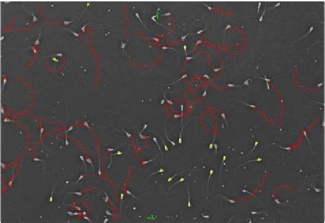 Photomicrograph of sperm motility (CASA, 600X). | Download Scientific ...