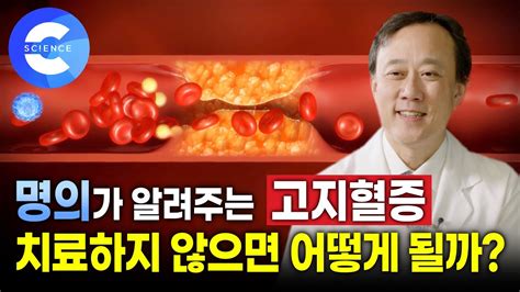 고지혈증 원인과 증상 및 치료 방법은 이슈앤피플