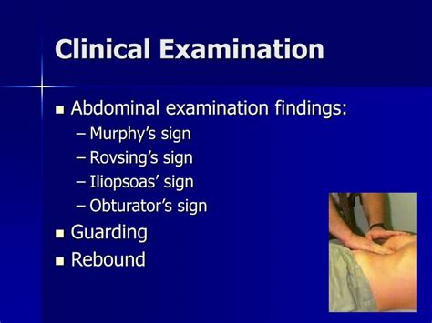 Ppt Acute Abdomen Powerpoint Presentation Id246449