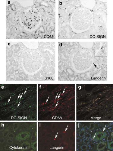 Compartment Specific Expression Of Dendritic Cell Markers In Human