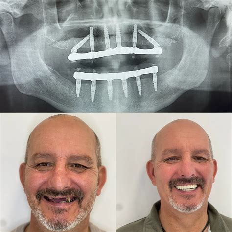 Proclinix Dental Implant Centre Proclinix Dental Implant Centre