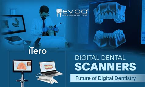 Intraoral Scanners for Dentist