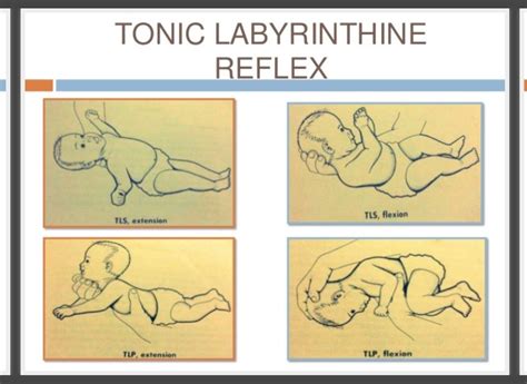 Benefits Of The Tonic Labyrinthine Reflex (TLR) For Optimal, 56% OFF