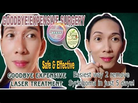 Nd Review Herbal Kasoy Cream Mabisa Pangtanggal Ng Syringoma And Etc