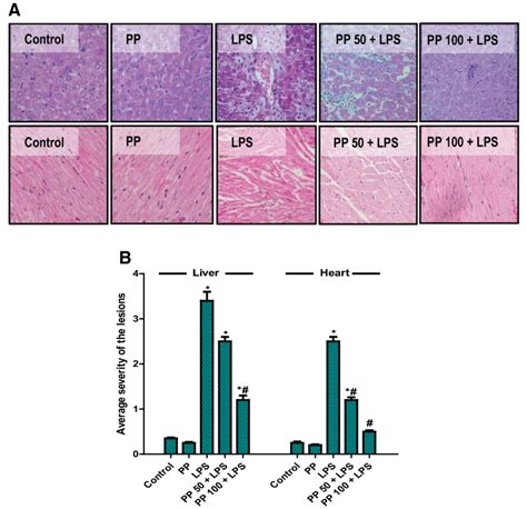 Pp Ameliorated Lps Induced Histopathological Damage In Hepatic And