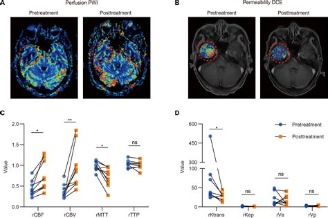 A Phase 2 Study Of Thalidomide For The Treatment Of Radiation Induced