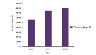 Ipf Incidence Uk Data Showed Incidence Has Increased In Recent Years