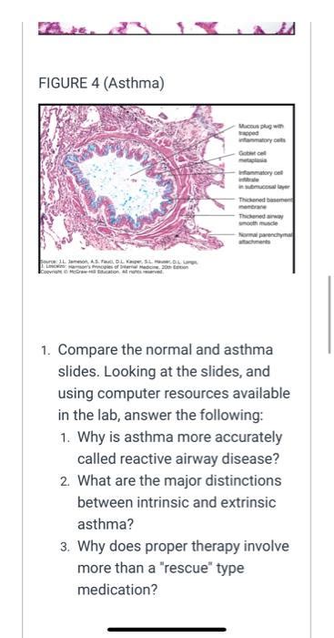 Solved FIGURE 4 (Asthma) Mucus plug with acped infamatory | Chegg.com