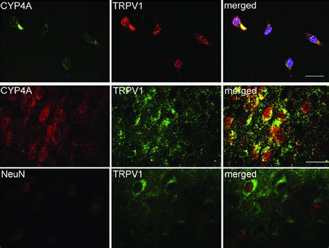 Double Immunofluorescent Staining Indicates That Cyp A And Trpv Are