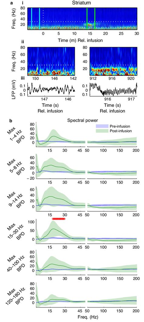 Carbachol Selectively Increases B Oscillations In Striatum A Download Scientific Diagram