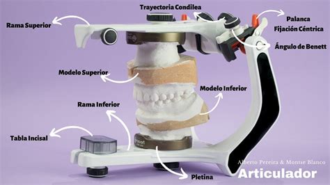 Montaje En Articulador Semi Ajustable YouTube