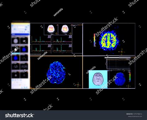 21 Brain Spectroscopy Images Stock Photos Vectors Shutterstock