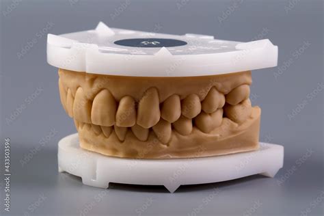 Mold Of Teeth Gypsum Model Plaster Of Teeth Stomatologic Plaster Cast