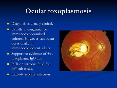 Congenital Toxoplasmosis Chorioretinitis