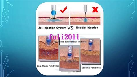 Dental Anesthesia Dental Anaesthesia Techniques & Complications | PPT