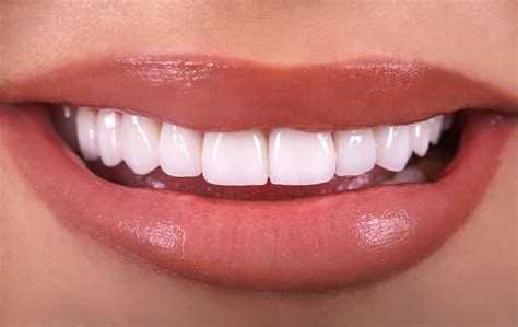 Quickly Transform Your Smile With No Prep Lumineers Hoffman Dental Care