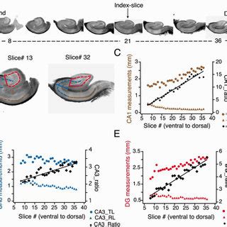 Measurement And Quantification Of The Anatomical Predictors Of Slice