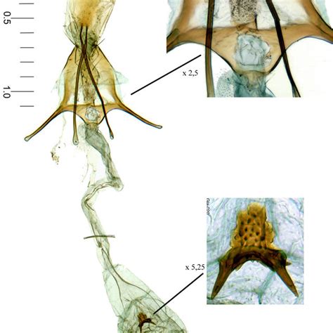 Megacraspedus Microsacculella Sp Nov Genitalia ♀ Allotype G Download Scientific Diagram