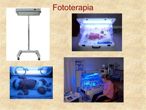 Ictericia Neonatal Y Su Clasificación Cuadro Clinico Ppt Descarga Gratuita