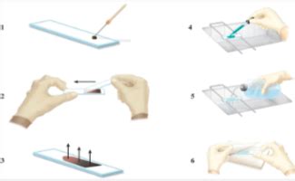 Microbio Lab Staining Capsule Staining Flashcards Quizlet