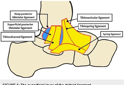 Figure 1 from Combined Deltoid and Spring Ligament Reconstruction Using ...