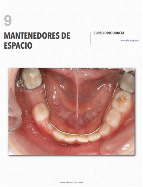 Odontocat Curso Online De Ortodoncia