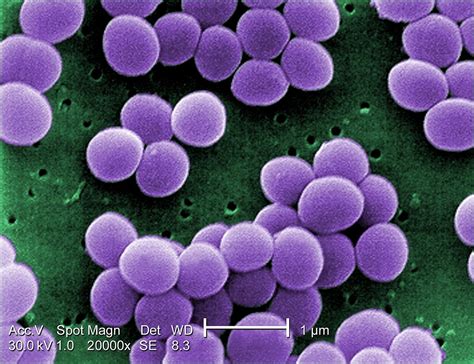 Staphylococcus aureus - Wikipedia