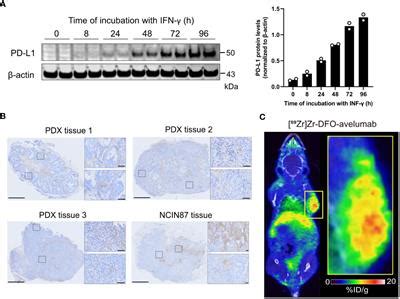 Frontiers Pd L Has A Heterogeneous And Dynamic Expression In Gastric