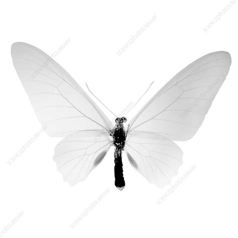 Butterfly, X-ray - Stock Image - F030/9947 - Science Photo Library