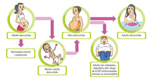 La malnutrición Escolar ABC Color