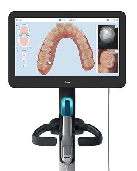 Itero Element 3d Scanning Orthodontist North Arlington Na Ortho