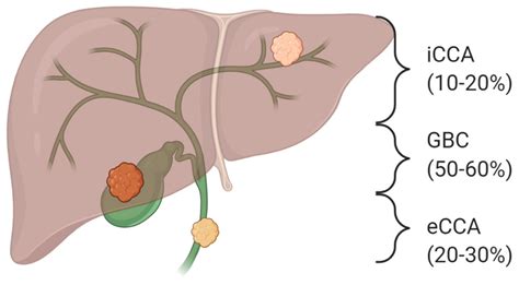 Cancers Free Full Text Idh Signalling Pathway In Cholangiocarcinoma