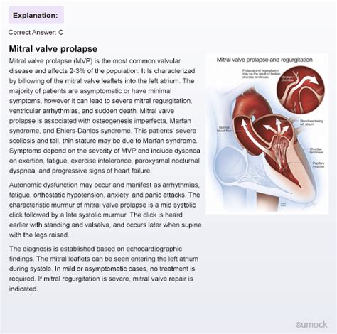 Usmle Step Ck Practice Questions Practice Test Umock