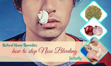 Top 14 Natural Home Remedies How To Stop Nose Bleeding Instantly