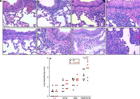 Mouse Lung Histopathology A Histological Images Of H E Stained Lung