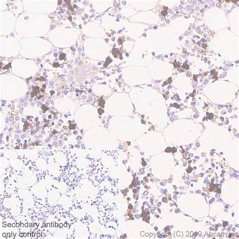 Anti Carbonic Anhydrase Ca Epr Ab