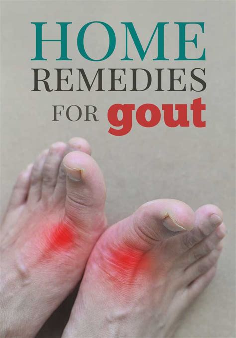how to treat the gout at home