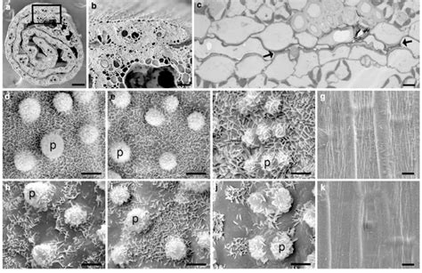 Electron Micrographs Of Wild Type And Wsl A Cross Section Of A Curled