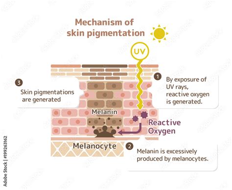 Mechanism Of Skin Pigmentation Skin Spot Illustration Stock Vector