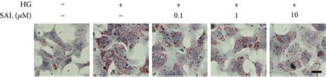 Salidroside Sal Improves Abnormal Lipid Accumulation And Ampk