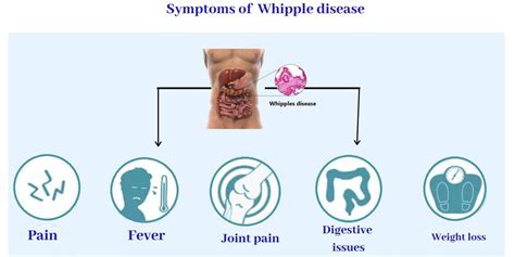 Whipple Disease