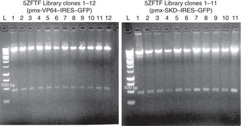 Agarose Gel Recipe Tae Dandk Organizer