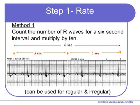 Step Process To Rhythm Interpretation Code One Cpr Training