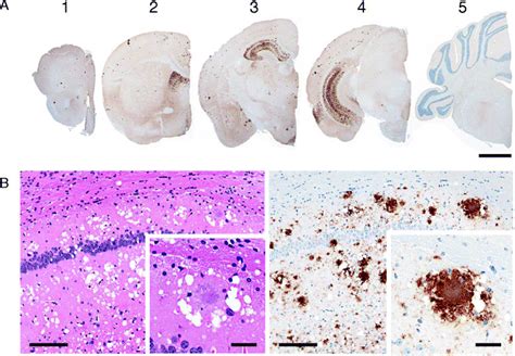 Neuroanatomical Distribution And Morphological Patterns Of PrP Sc